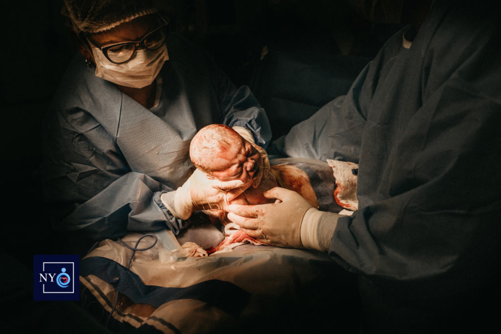 surgeons delivering newborn during botched c-section